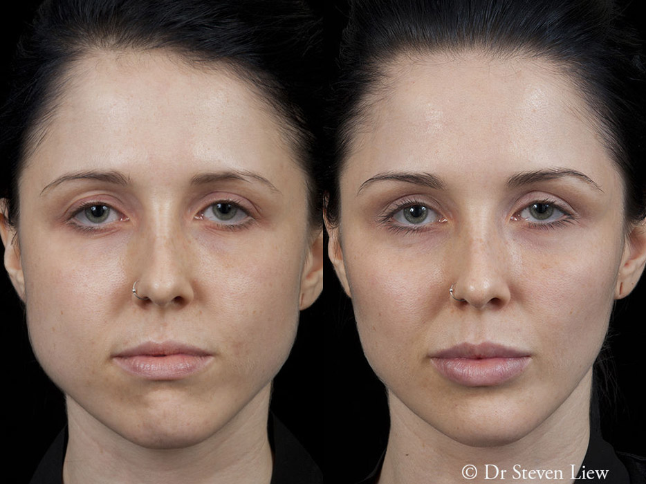 Total Face Enhancement results