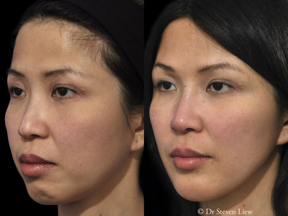 Total Face Enhancement results