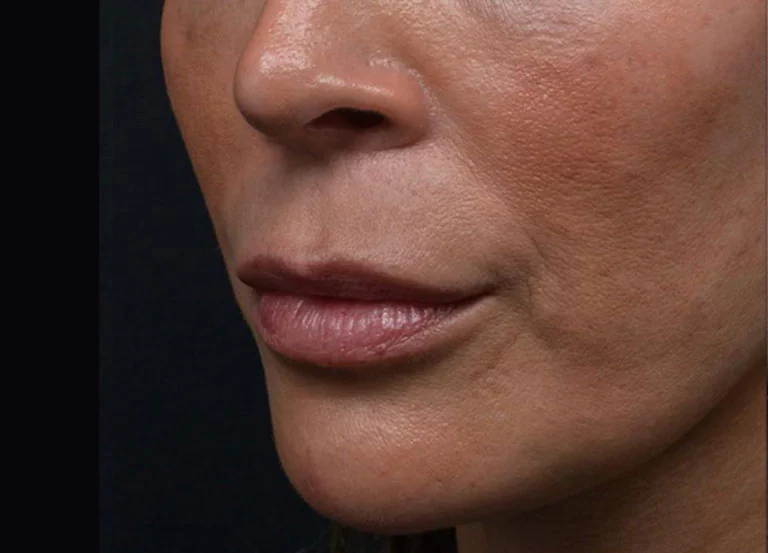 Close-up of a woman's lips and chin, showing smooth skin and natural lip color.
